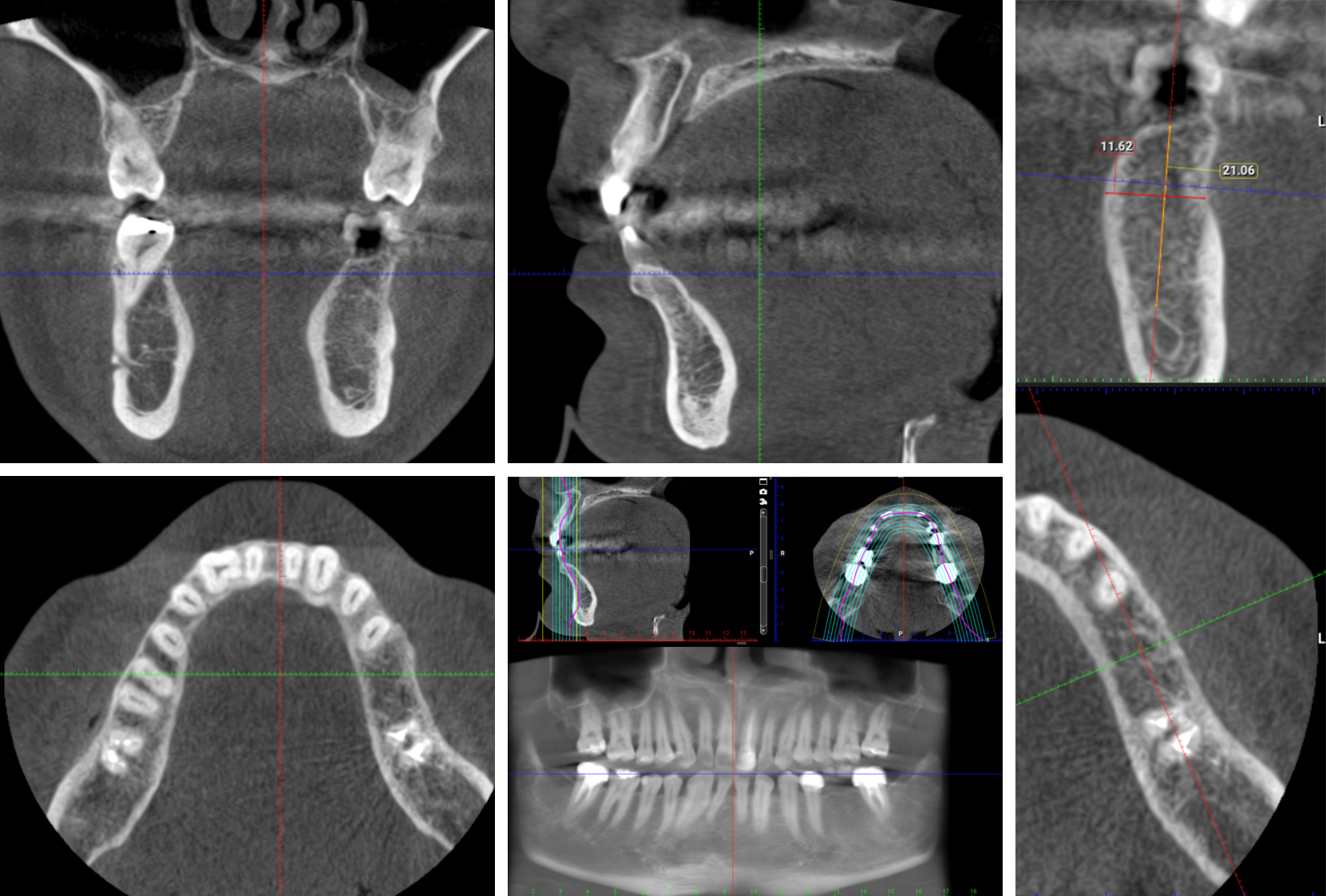 News Ct Scan Vs Cone Beam Ct An Overview News Ct Scan Vs Cone