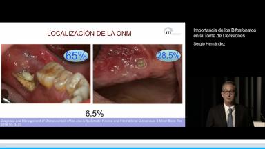 Importancia de los Bifosfonatos en la Toma de Decisiones - Congress ...