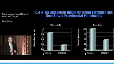 Contemporary Implant Designs – What Has Changed? - Congress