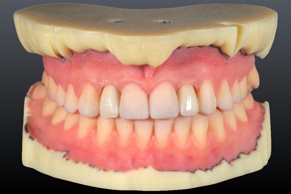 Fig. 38: Industrial 3D printer can operate different materials in the same print and produce objects with different colors, textures, gradients, transparencies and durometers in a single print operation. These dental casts were printed with a PolyJet printer (J750; Stratasys Ltd)