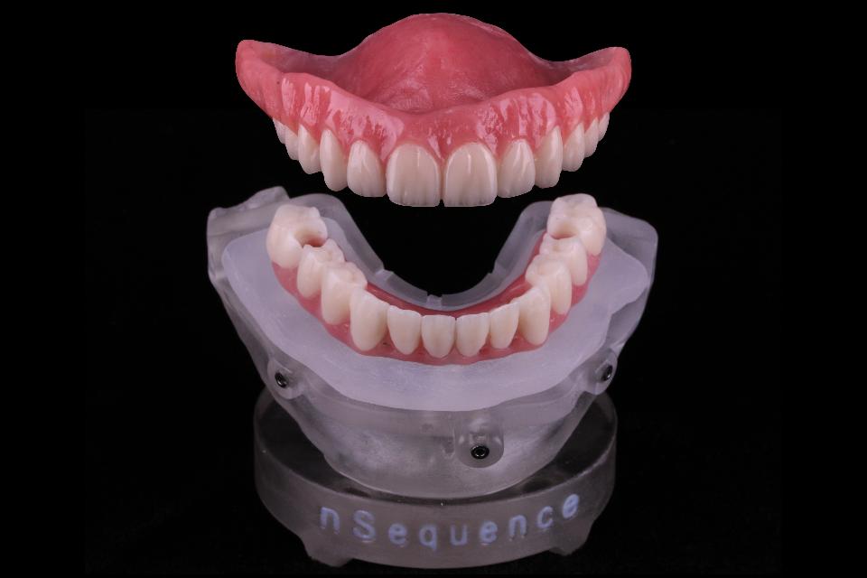 Fig. 23: CAD/CAM interim prostheses for planned immediate provisionalization