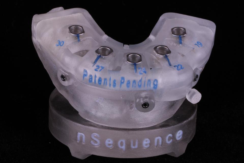 Fig. 22: CAD/CAM surgical templates for planned s-CAIS